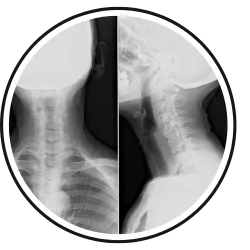 Gonstead System - Chiropractor Melrose MA | New Patient